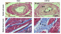 High-fat diet feeding reduced smooth muscle contractility and increasing tissue programmed death activity in rats bladder tissue
